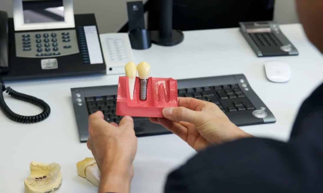 Zahnimplantate Herten