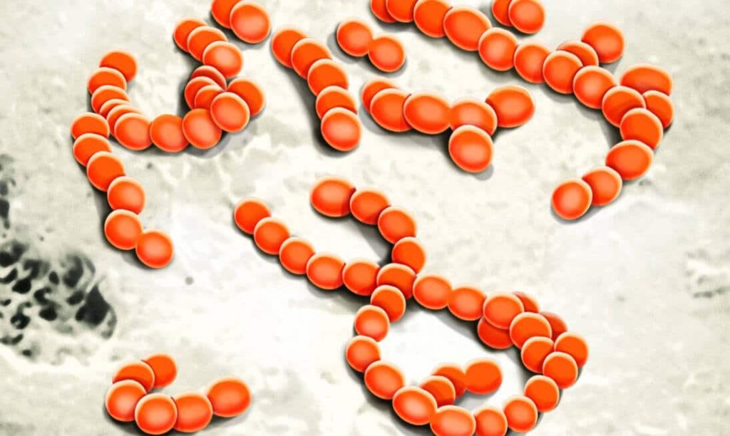 Bakterientest Zahnarzt