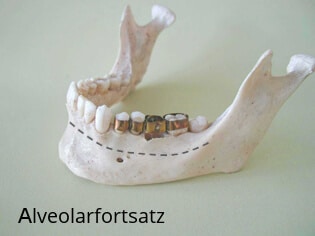 Alveolarfortsatz