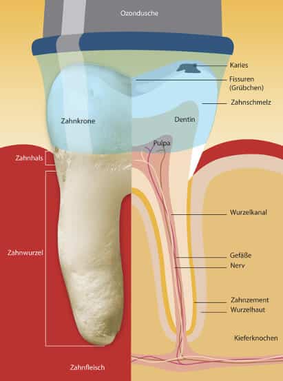 ozonbehandlung zahnarzt