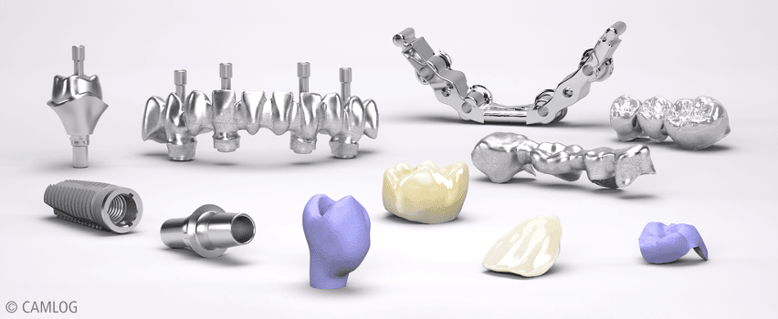 zahnlücke schließen zahnersatz möglichkeiten