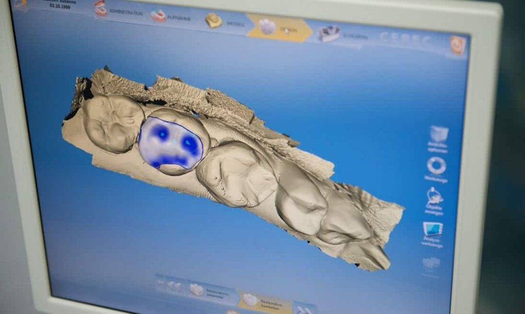 cad cam technologie zahnersatz