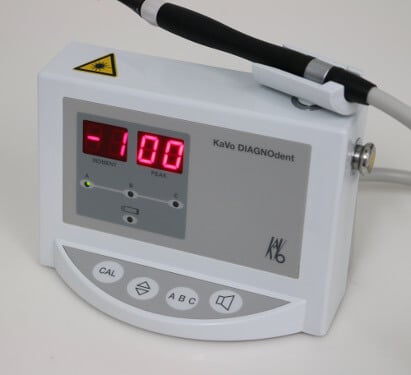 KaVo Diagnodent Pen - Karies erkennen laser