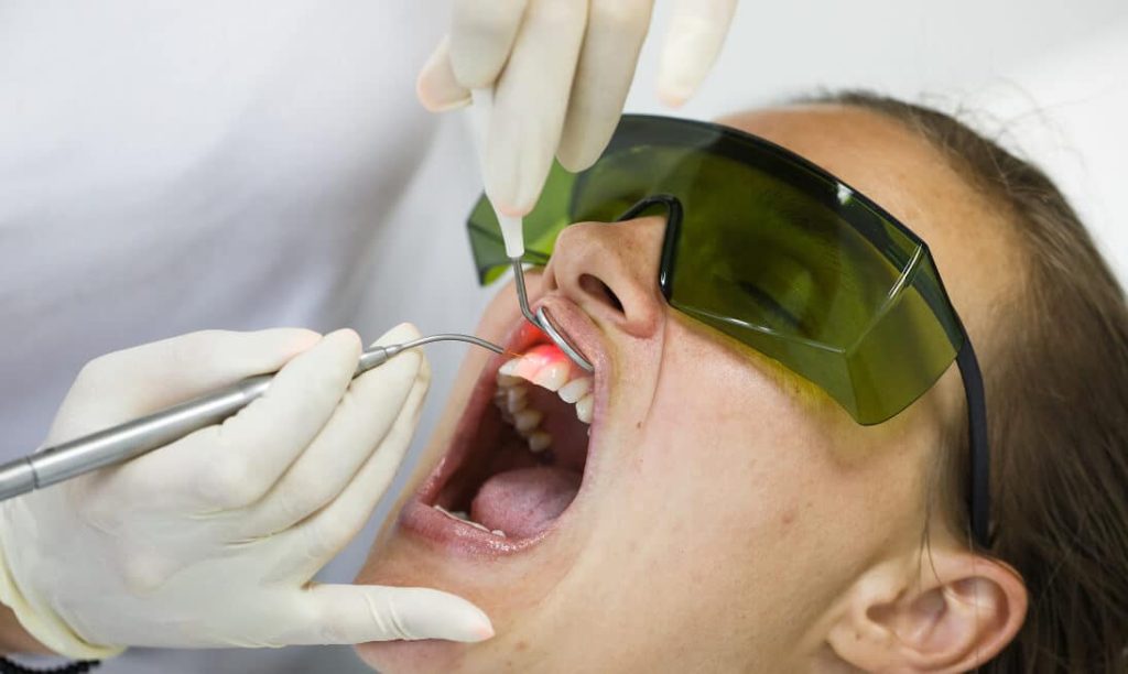 Laserbehandlung 2 laserbehandlung