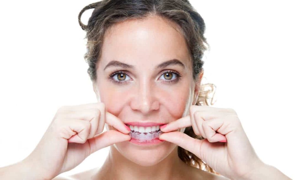 Einsetzen der unsichtbare Zahnspange Invisalign