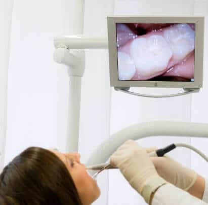 karies diagnostik intraoralkamera