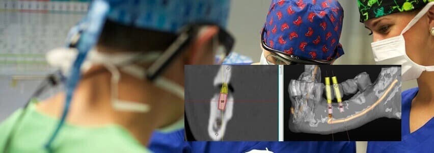 3d computernavigierte implantologie klinik waltrop