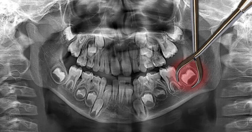 Zahnklinik: Minimalinvasive Oralchirurgie Dorsten und Umgebung