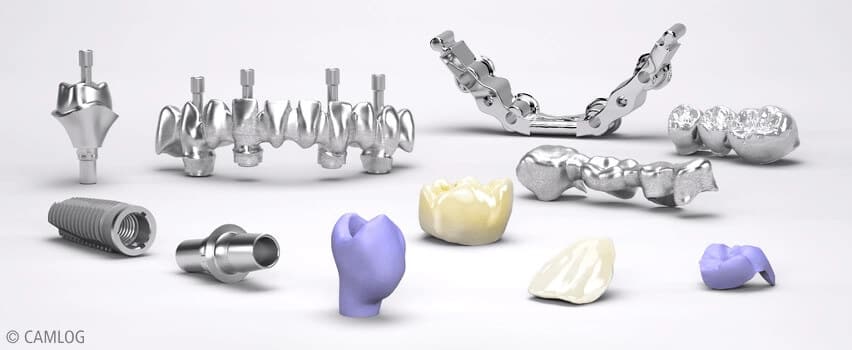 Dentallabor Zahnersatz aus der Zahnklinik Bottrop