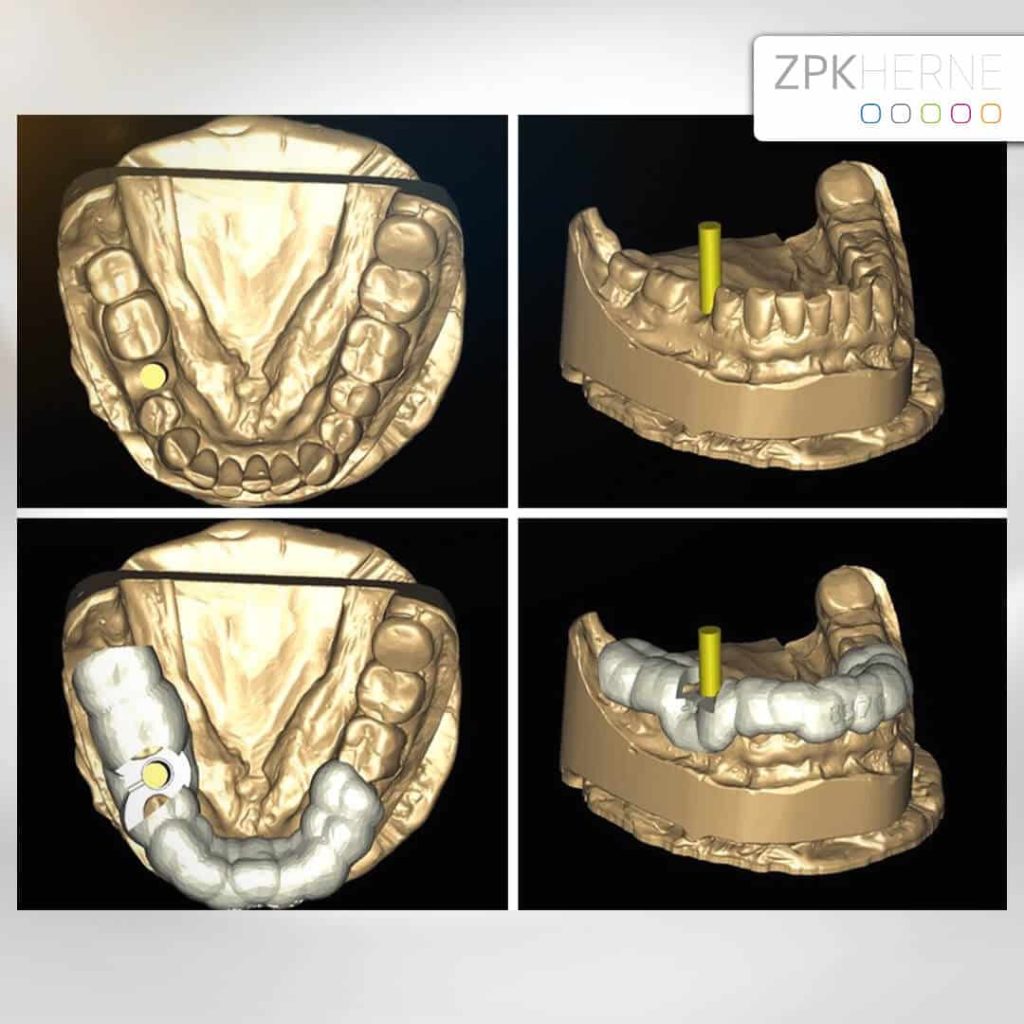 DVT - Diagnostik - Sofortversorgung