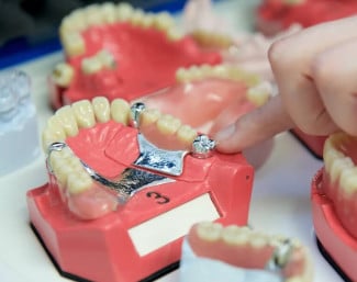 Cover-Denture-Prothesen