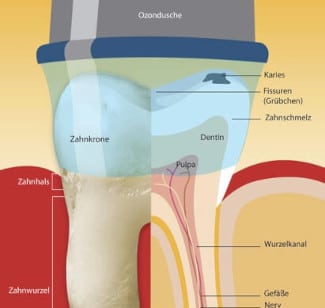 Ozontherapie