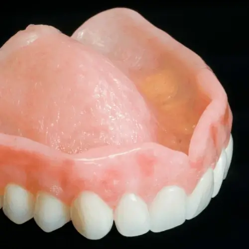 Oberkieferprothese