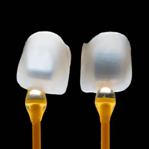 Veneers