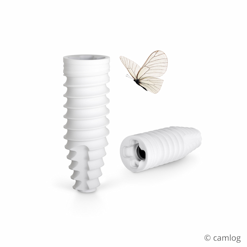 Keramikimplantat - Ceralog Progressive Line