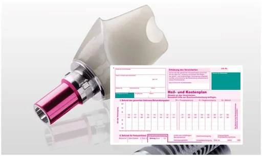 Zahnimplantate Kosten: Zahnimplantat mit Heil-& Kostenplan