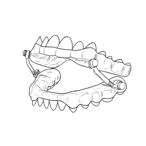 Illustration einer zweiteiligen Protrusionsschiene mit Gelenkverbindung