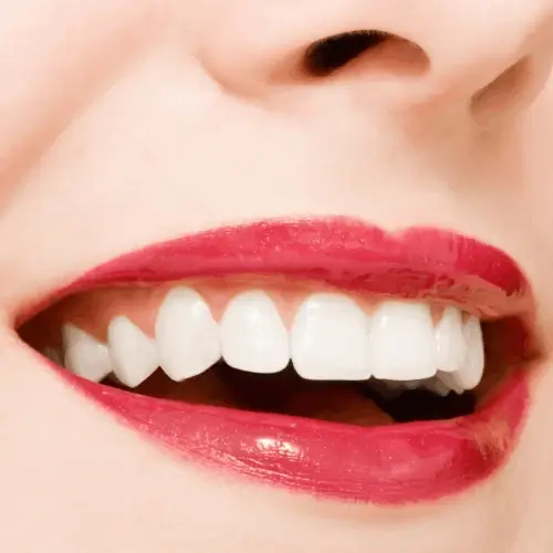 Hollywood Smile - Frau mit Lippenstift