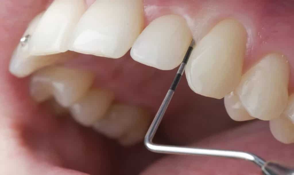 Ästhetische Zahnheilkunde - Parodontologie