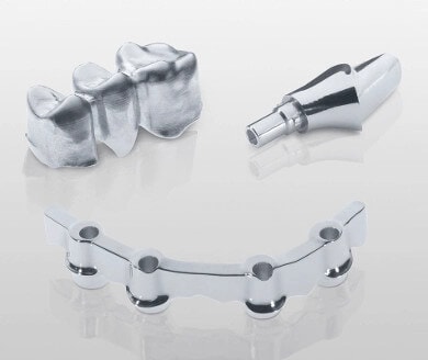 Metalllegierungen: Kronen, Implantate, Stege