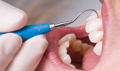 vitalitätsprüfung zahn
