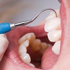 Vitalitätsprüfung beim Zahnarzt in Herne
