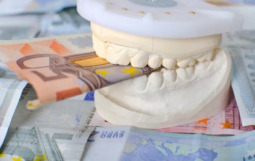 Zahnimplantate - Kosten nach Lebensdauer